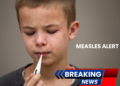 New Measles Alert: Multiple Sydney Locations Exposed as Vietnam Travel Link Confirmed