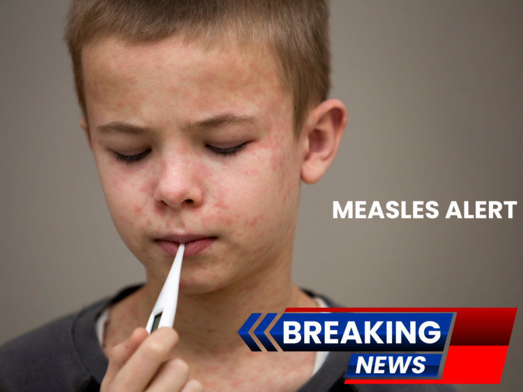 New Measles Alert: Multiple Sydney Locations Exposed as Vietnam Travel Link Confirmed