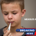 New Measles Alert: Multiple Sydney Locations Exposed as Vietnam Travel Link Confirmed